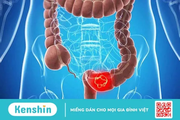 Làm gì khi bị đau bụng dưới ở nam? 2