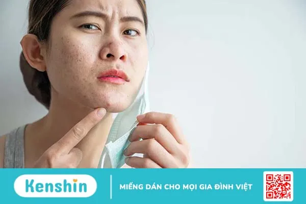 Lăn kim trị mụn bị sưng phải làm sao?