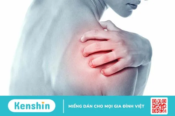 Lệch vai là gì? Cách khắc phục tình trạng lệch khớp vai 1