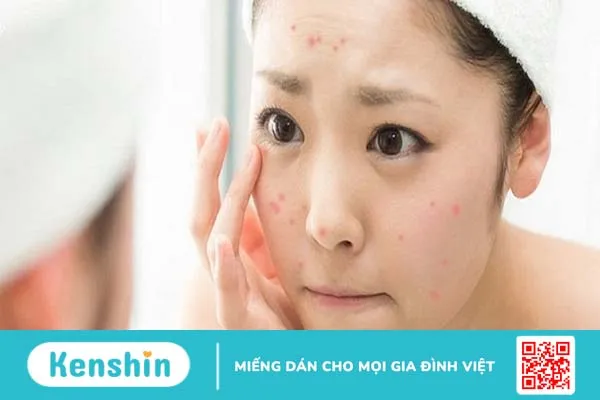 Lợi ích và cách sử dụng tinh dầu cây chè 2