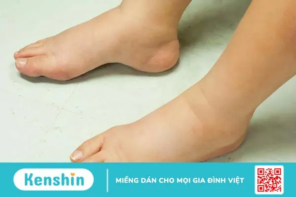 Mạch nghịch thường có nguy hiểm không? -2