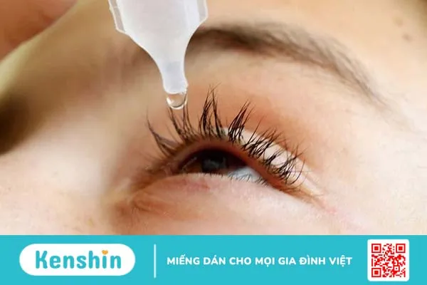 Mắt bị ghèn sợi: Nguyên nhân và xử trí 4