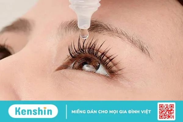 Mắt đổ ghèn: Nguyên nhân và cách điều trị 4