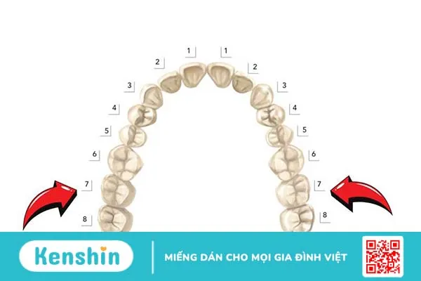 Mất răng số 7 có niềng răng được không 1