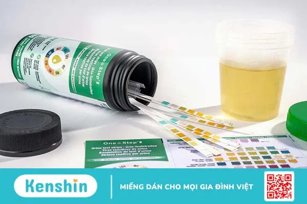 Máu trong nước tiểu: Nguyên nhân và cách điều trị 4