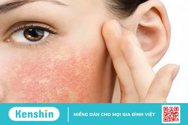 Mẹo chăm sóc da trước trong và sau khi xạ trị 1