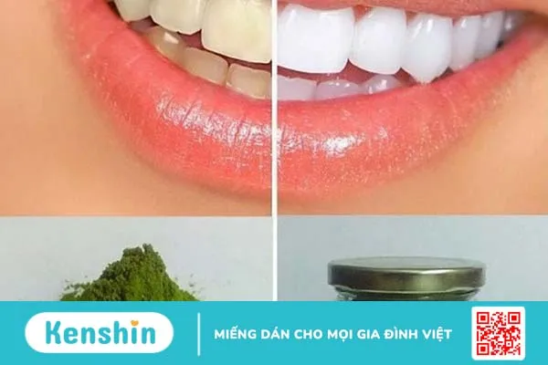 Làm trắng răng bằng trà xanh có hiệu quả không