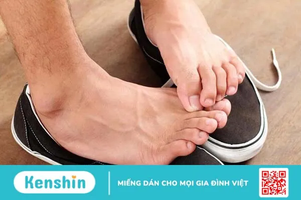 Trị hôi chân bằng kem đánh răng được không?