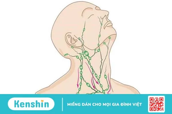 Mổ hạch ở cổ có nguy hiểm không? Lưu ý và các biến chứng sau mổ hạch 3