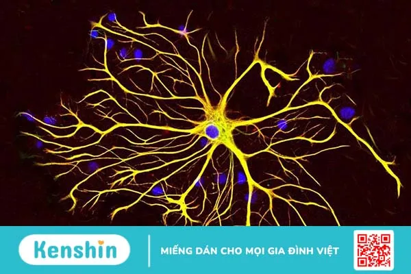 Mô thần kinh có chức năng gì? Biện pháp để duy trì hệ thần kinh luôn khỏe mạnh 4