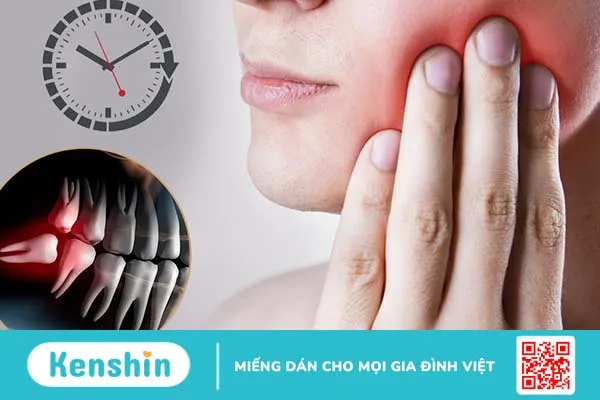 Mức độ nguy hiểm và hướng xử trí tình trạng mọc răng khôn nổi hạch 2