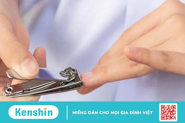 Móng tay bị hư và cách xử lý an toàn, hiệu quả 1