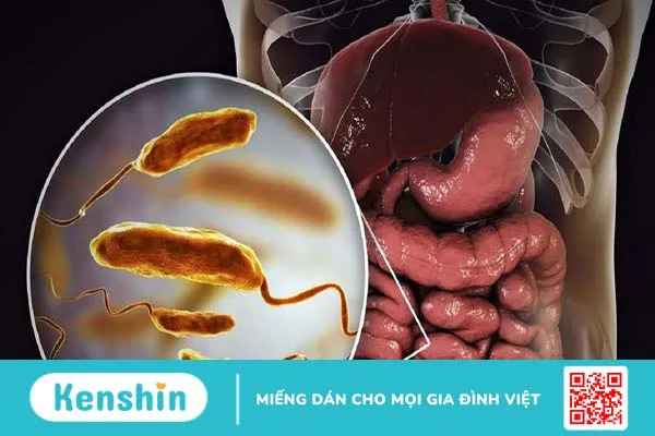 Morcvax: Vacxin đường uống giúp hỗ trợ và phòng ngừa bệnh tả 2