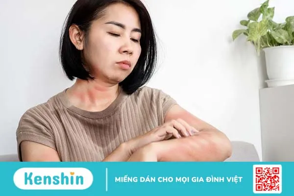 Một số thông tin cơ bản về kháng sinh nhóm Macrolid 3