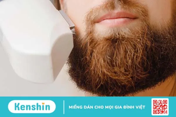 Nam giới có nên triệt râu không? Các phương pháp triệt râu vĩnh viễn 1