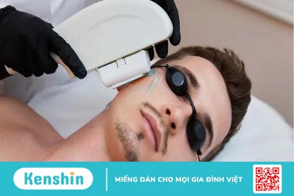 Nam giới có nên triệt râu không? Các phương pháp triệt râu vĩnh viễn 3