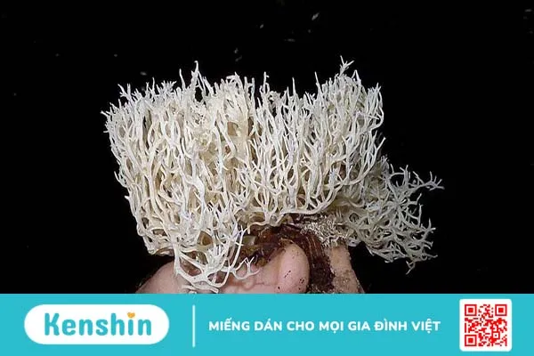 Nấm san hô ăn được không? Lưu ý khi sử dụng 1