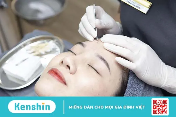 Nặn mụn xong bị lên mụn đầu trắng có sao không? 4