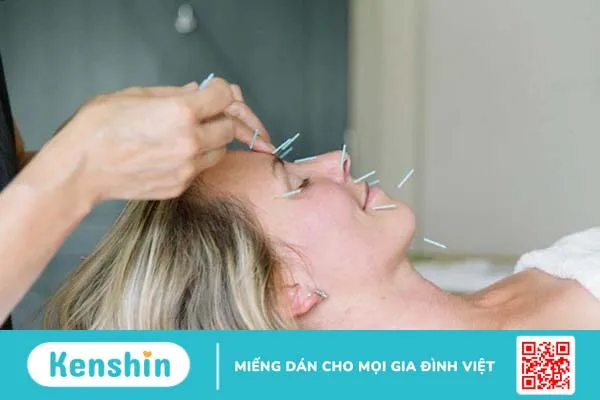 Nên chữa liệt dây thần kinh số 7 ở đâu?