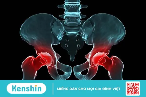 Nghiệm pháp patrick: Cách thực hiện và ý nghĩa chẩn đoán bệnh 3