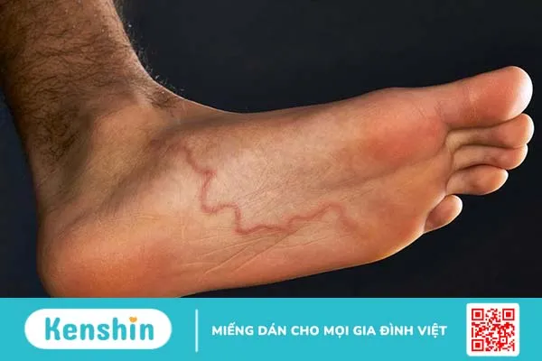 Người lớn có cần tẩy giun theo định kỳ không? 1