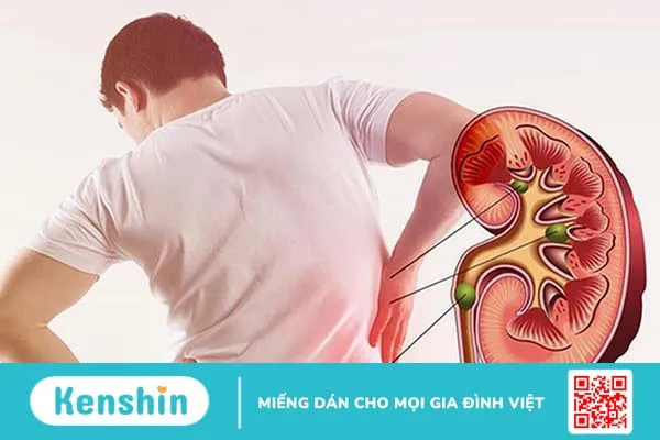 Nguyên nhân gây đau bụng dưới bên trái 3