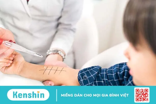 Nguyên nhân gây dị ứng sơn gel là gì? Cách xử trí dị ứng sơn gel như thế nào? 2