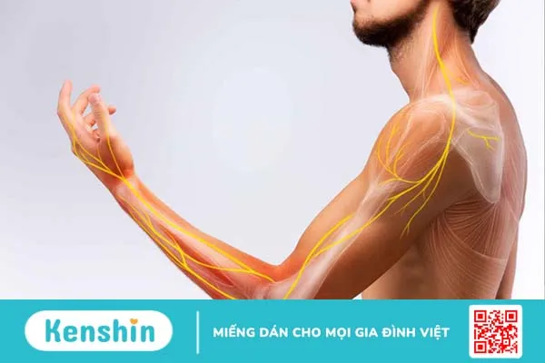 Nguyên nhân gây nổi hạch ở nách trái nam giới và phương pháp xử trí mà bạn nên biết 2