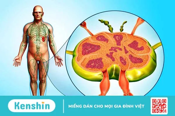 Nguyên nhân gây nổi hạch ở nách trái nam giới và phương pháp xử trí mà bạn nên biết 4