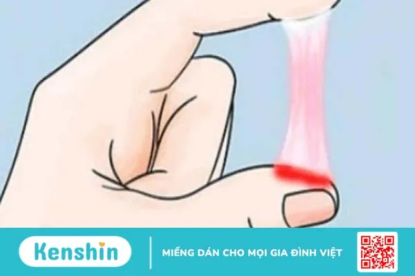 Nguyên nhân gây trễ kinh và ra dịch màu hồng 1