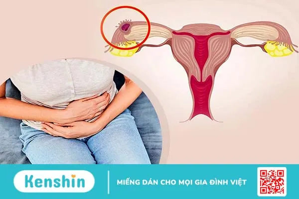 Nguyên nhân gây trễ kinh và ra dịch màu hồng 4