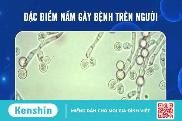 Nhiễm nấm có nghiêm trọng không?