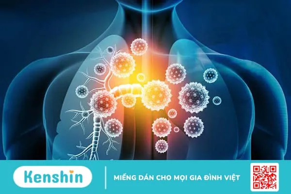 Nhiễm trùng đường hô hấp dưới: Viêm phế quản 3