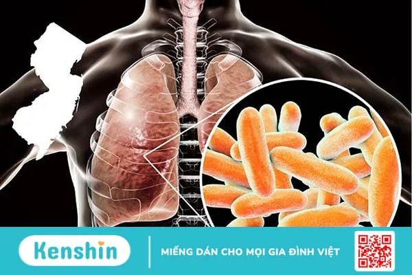 Nhiễm trùng Legionella và viêm phổi do Legionella có nguy hiểm không? 2