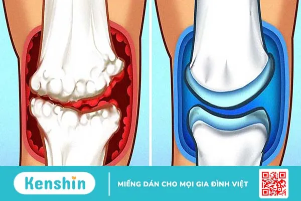 Nhiệt độ nước vòi sen có thể ảnh hưởng đến sức khỏe như thế nào? 2