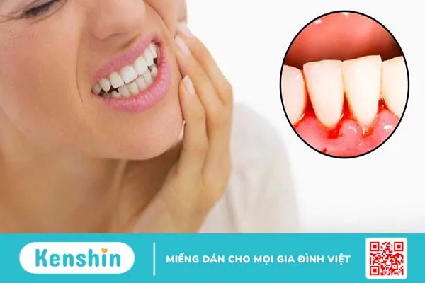 Nhiệt miệng chảy máu chân răng có sao không? Phòng ngừa bằng cách nào? 4