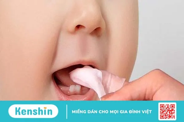 Nhiệt miệng ở trẻ dưới 1 tuổi: Nguyên nhân, triệu chứng và cách xử lý hiệu quả 4