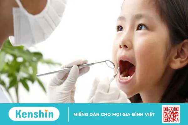 Nhiệt miệng ở trẻ em do nguyên nhân gì? Làm sao điều trị? 6