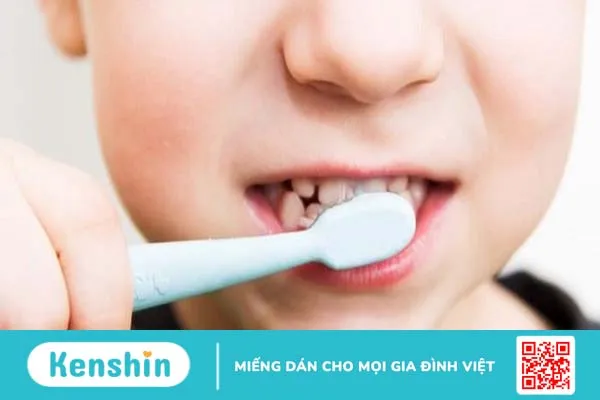 Nhiệt miệng ở trẻ em do nguyên nhân gì? Làm sao điều trị? 3