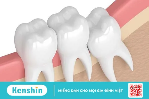 Nhổ răng khôn có được bảo hiểm không 02