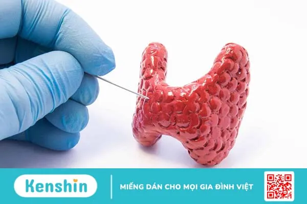 Nhu mô tuyến giáp không đều cảnh báo bệnh gì? 3