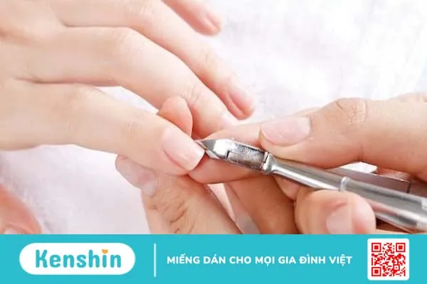 Đặc điểm nấm gây bệnh trên người