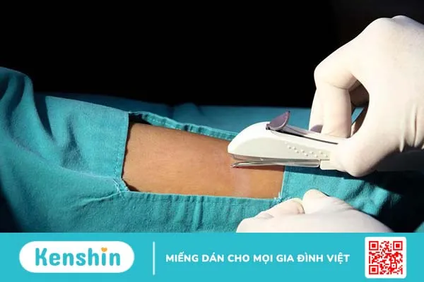 Những điều cần biết về que cấy Implanon 2