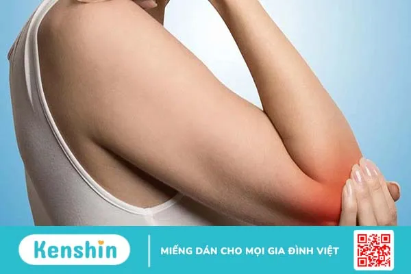 Những điều cần biết về viêm điểm bám gân lồi cầu ngoài xương cánh tay 3