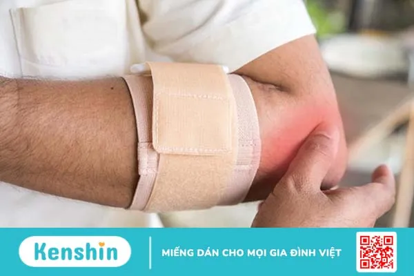 Những điều cần biết về viêm điểm bám gân lồi cầu ngoài xương cánh tay 4