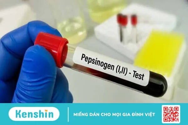 Những điều nên biết về xét nghiệm pepsinogen 1