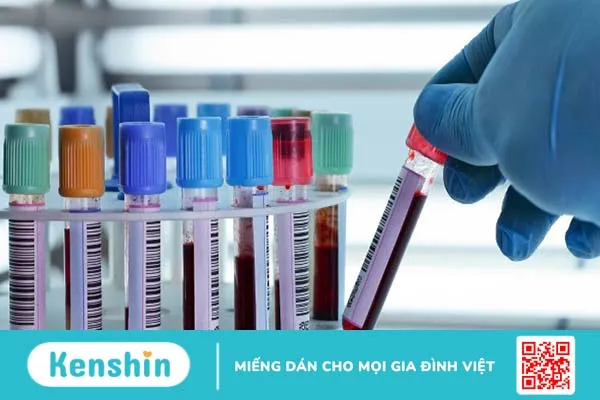 Những điều nên biết về xét nghiệm pepsinogen 2