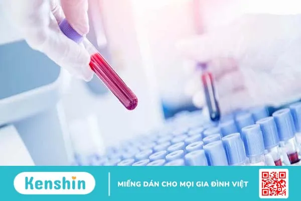 Những điều nên biết về xét nghiệm pepsinogen 3