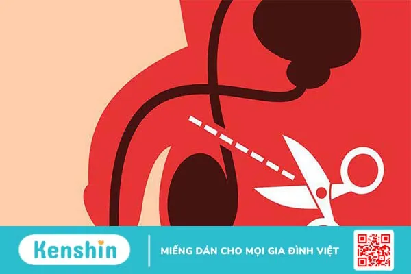 Những điều phái nam cần biết về vấn đề thắt ống dẫn tinh 2