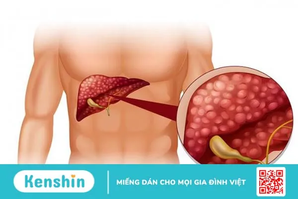 Những người không nên ăn quả bơ nên chú ý  3